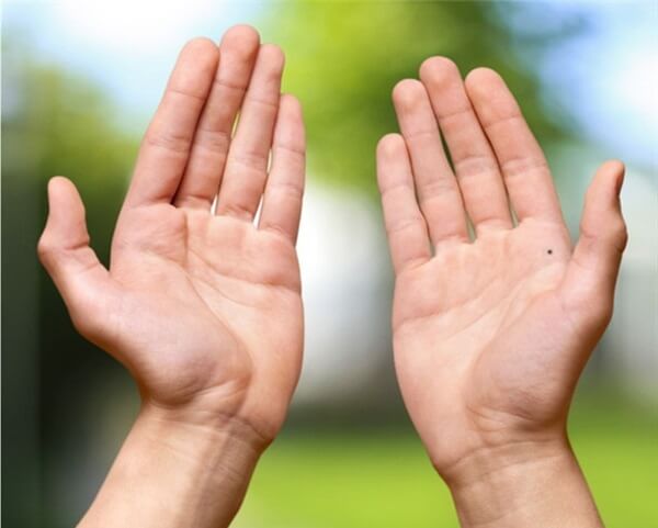 Ý nghĩa nốt ruồi ở lòng bàn tay nam có ý nghĩa gì?