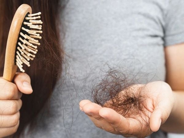 Khám phá chi tiết nằm mơ thấy rụng tóc là điềm báo gì?