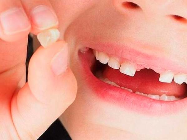 Nằm mơ bị gãy răng cửa là điềm gì? Có phải điềm xấu không?